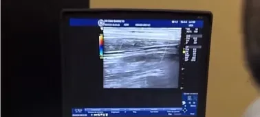 Ultrassom Doppler